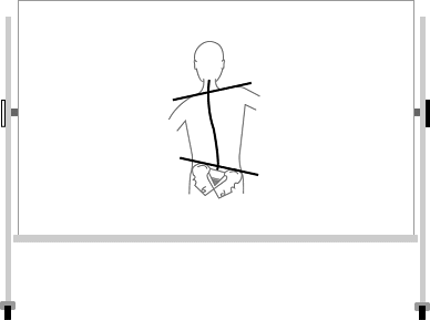 歪みの図