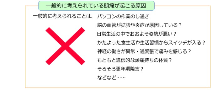 頭痛説明2